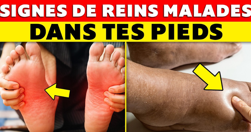 pieds pieds