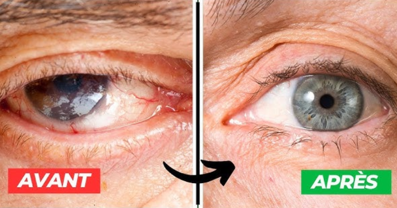 la nature,yeux La Nature